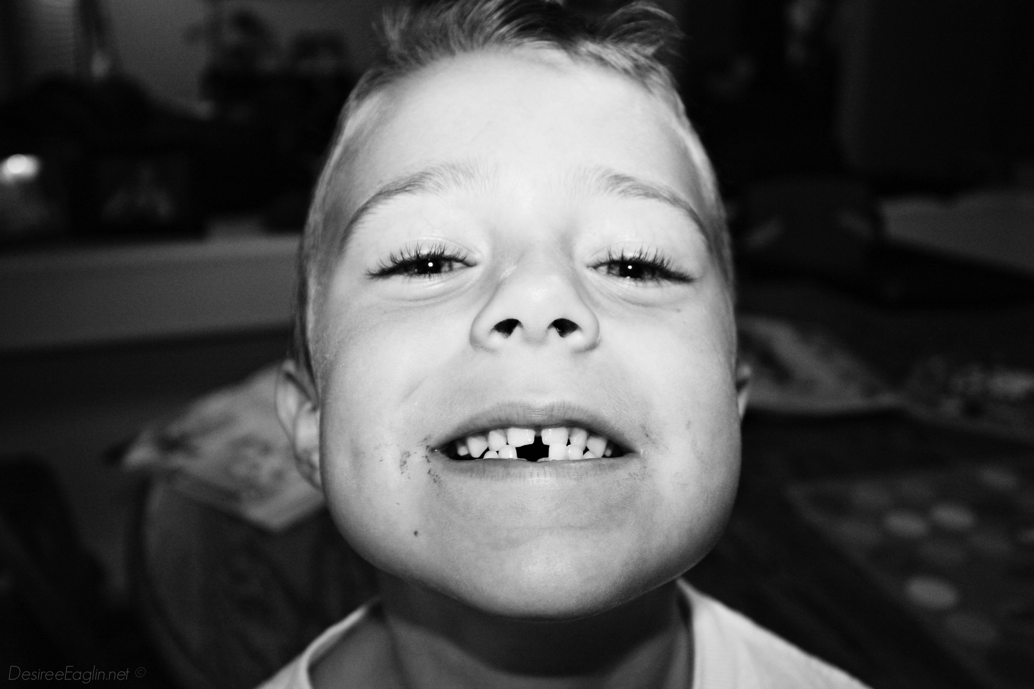 lost tooth, first lost tooth, loose teeth, kids teeth, kids losing teeth